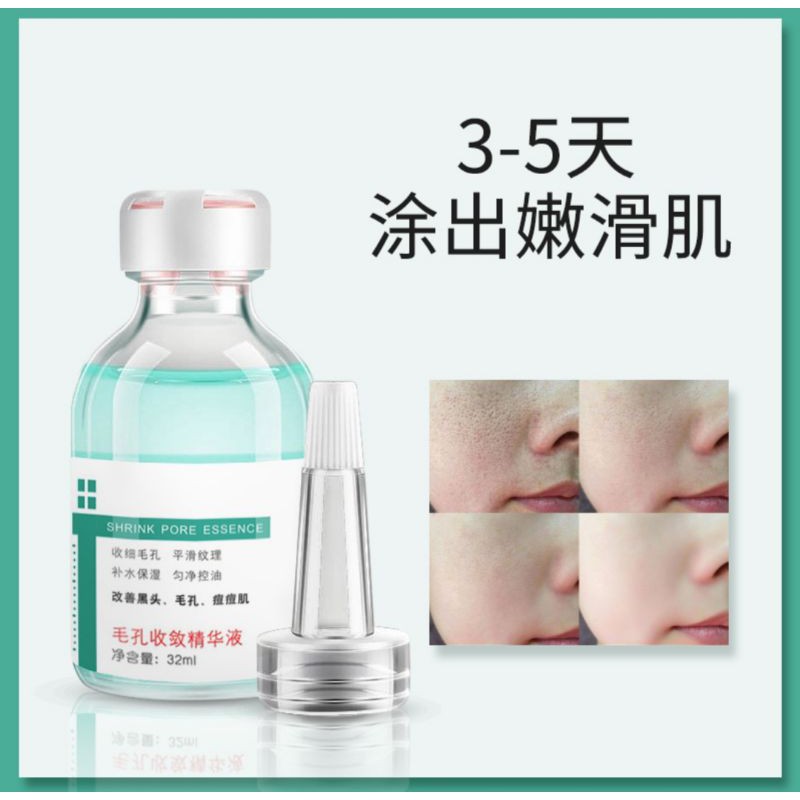CHÍNH HÃNG — Serum Se Khít Lỗ Chân Lông Thần Thánh | BigBuy360 - bigbuy360.vn