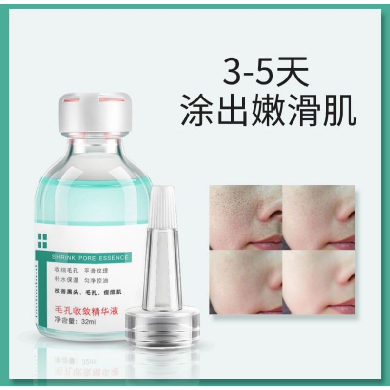 CHÍNH HÃNG — Serum Se Khít Lỗ Chân Lông Thần Thánh