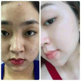 BỘT CÁM GẠO CAO CẤP.ANTHY