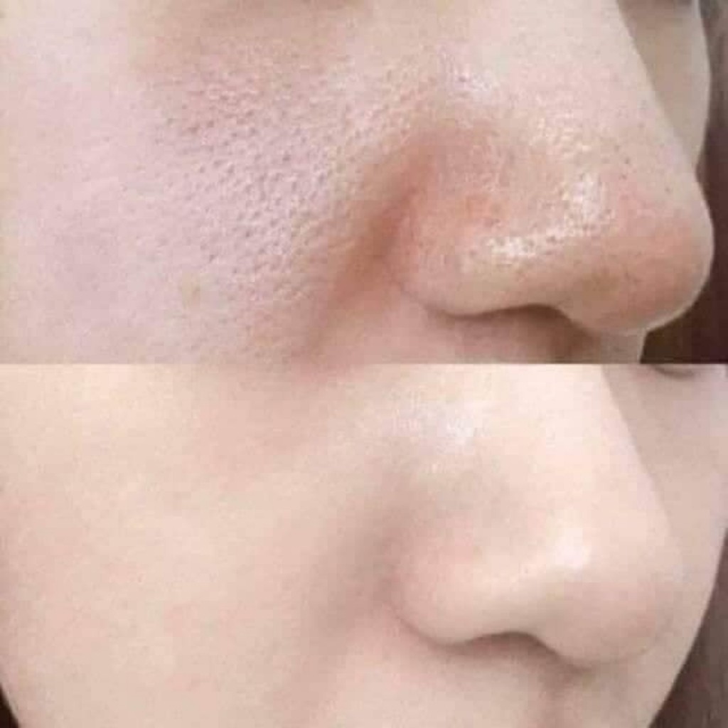 Tế bào gốc POCIA giảm lỗ chân lông to lọ 10ml