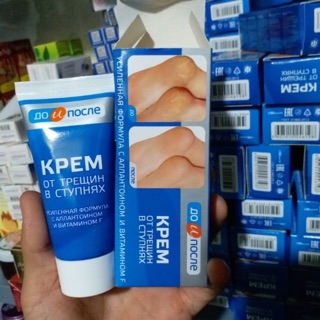 Kem trị nứt gót chân Nga