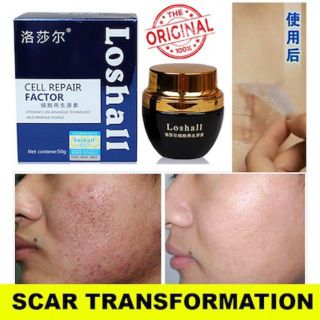 KEM TRỊ SẸO LOSHALL SCARS REMOVE