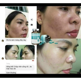 Viên Uống Trắng Da