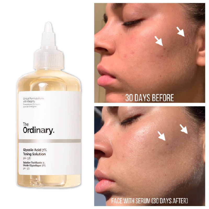 Toner Dưỡng Sáng Đều Màu Da The Ordinary Glycolic Acid 7% Toning Solution 240ml Làm Sáng Da Giúp Da Mịn Màng