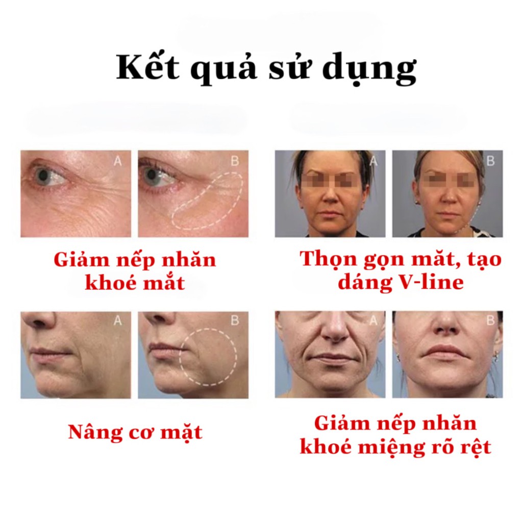 Máy nâng cơ mặt Korona cao cấp chống nước, công nghệ ENI điện di tinh chất, trẻ hoá da, massage mặt Nanotime Beauty