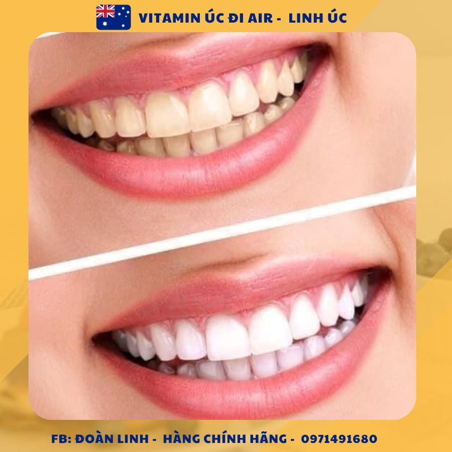 Kem Đánh Răng Crest 3D White Advanced Whitening 158, Hàng chuẩn đi air, Kem Đánh Răng Crest 3D - Mỹ