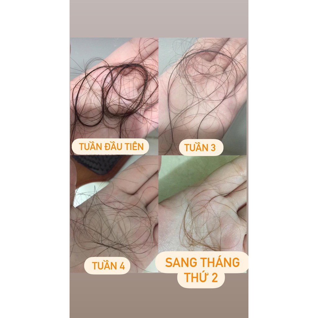 Tinh dầu dưỡng tóc bưởi Vijully kích mọc tóc, giảm rụng, làm dày tóc, hết bết, nhanh dài 100ml - TẶNG KÈM QUÀ XINH | BigBuy360 - bigbuy360.vn