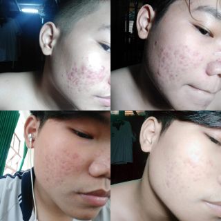 Thảo dược tái tạo da