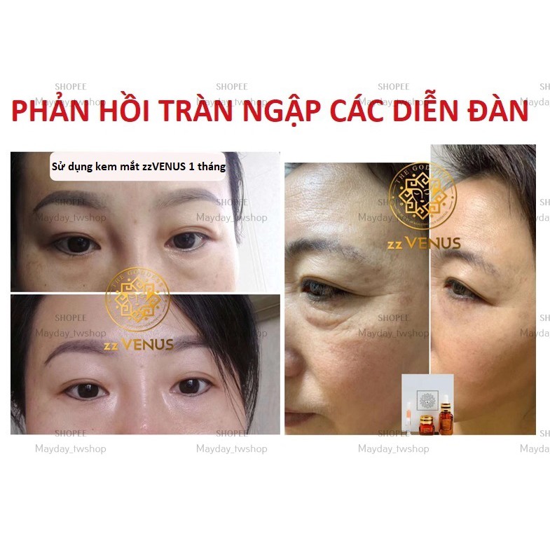 Kem Dưỡng Vùng Mắt zzVENUS Advanced Night Repair Eye Concentrate Matrix [25ml + 15ml + 1ml] | BigBuy360 - bigbuy360.vn