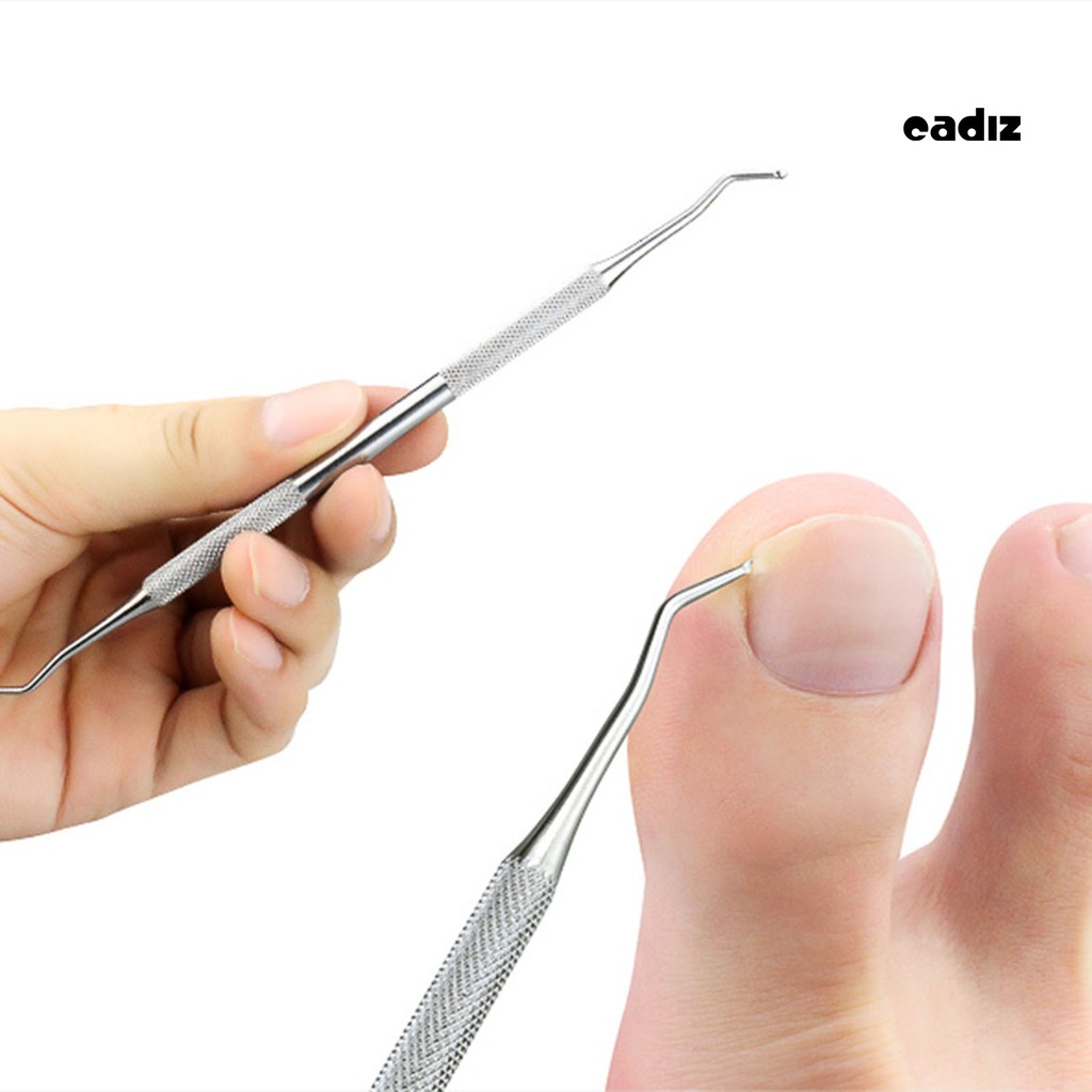 [Hàng mới về] Dụng cụ nâng móng chân/móng tay mọc ngược
