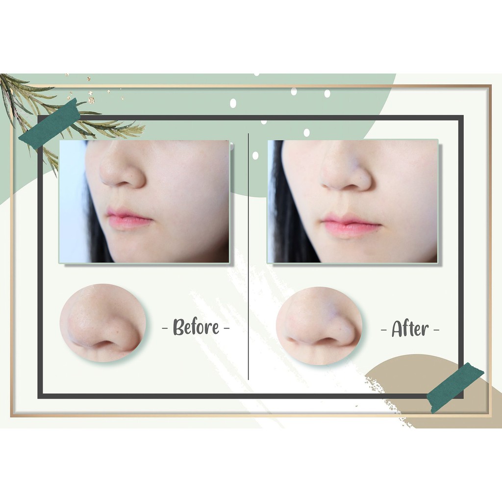 Gel lột mụn trà xanh Nakiz Nose ♥️ Hút sạch mụn cám, mụn đầu đen. Thải độc chì- Sáng da