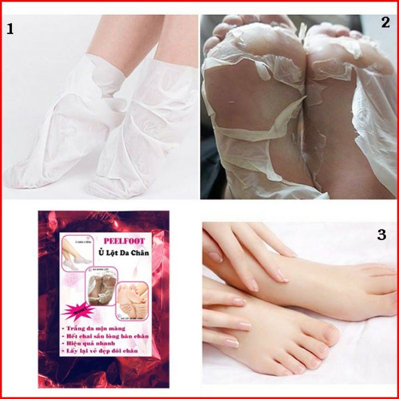 Ủ Lột Da Chân Hết Chai Sần Trắng Da