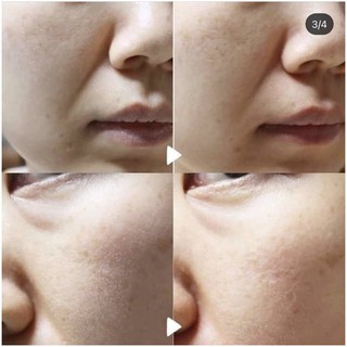 SERUM SKIN1004 MADAGASCAR CENTELLA AMPOULE