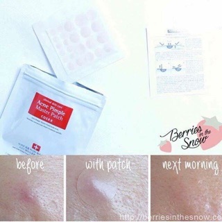 Miếng Dán Mụn Cosrx Master Patch