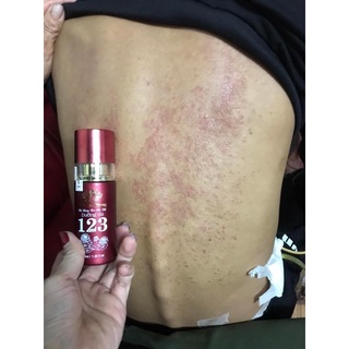 Dưỡng da 123 Bạch linh - Bách y sâm (40ml)