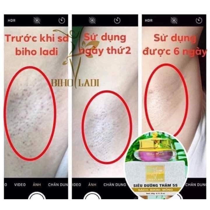 Chính hãng - Biho Ladi - Kem Siêu dưỡng thâm 5S 20gram | BigBuy360 - bigbuy360.vn