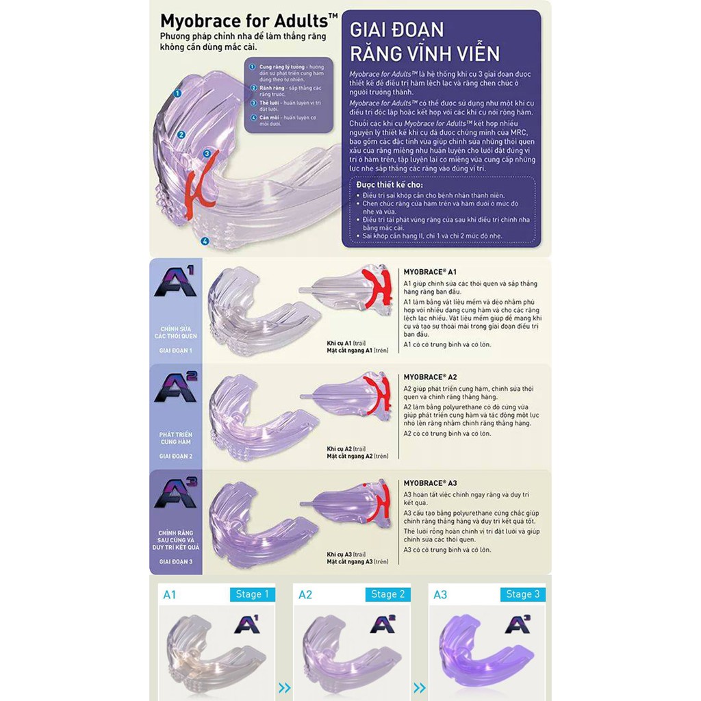 Máng Myobrace Trainer A1, A2,A3