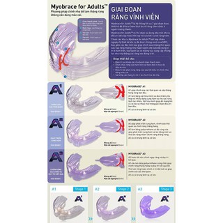 Máng Myobrace Trainer A1, A2,A3