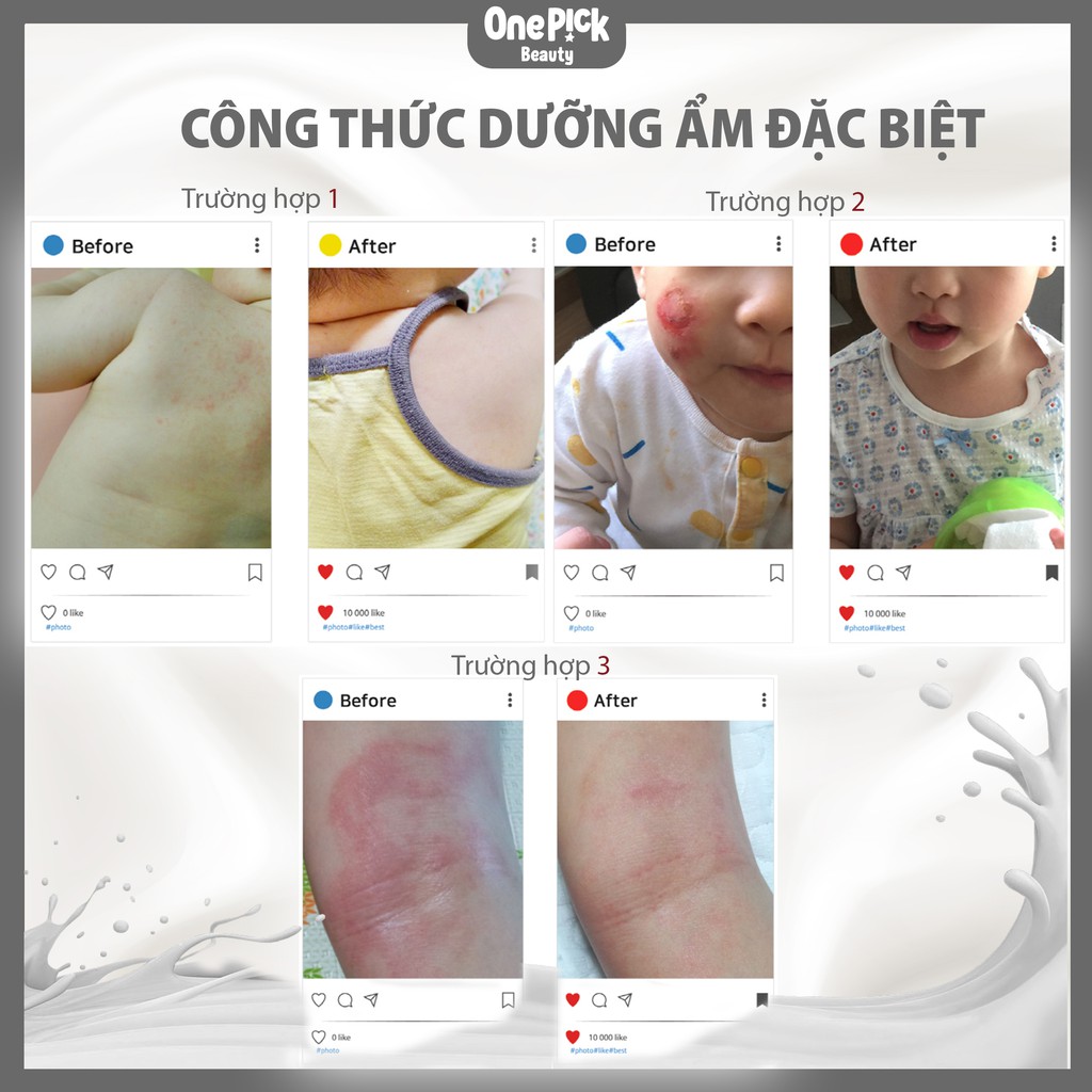 Kem dưỡng Ato Cream chiết xuất sữa lừa,dầu lừa và thành phần tự nhiên trị chàm sữa và làm dịu da,dưỡng ẩm làn da trẻ nhỏ [Dr.Donkey  Ato Cream 100g - 200g]