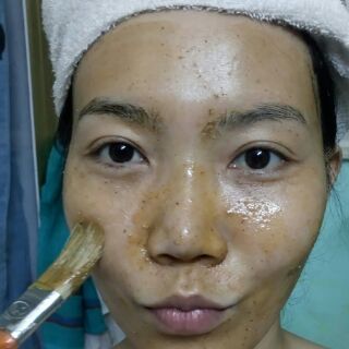 Mặt nạ dưỡng da