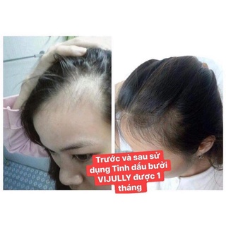TINH DẦU BƯỞI VI JULLY 100ML