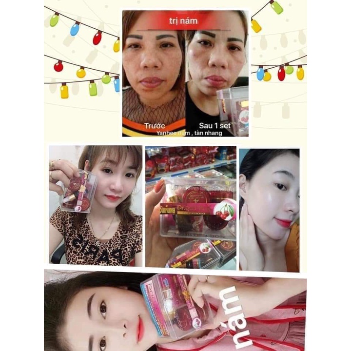 SET KEM NÁM TÀN NHANG YANHEE ĐỎ THÁI LAN