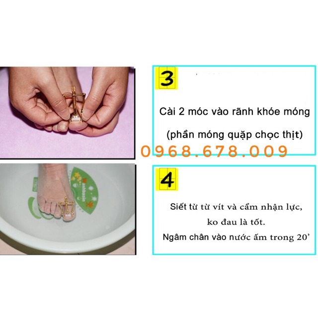 DỤNG CỤ CHỮA MÓNG QUẶP, MÓNG CHÂN BỊ CHỌC THỊT GÂY ĐAU ( LOẠI 1 )