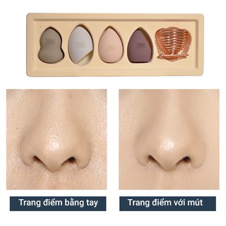 MÚT TÁN NỀN HOLD LIVE