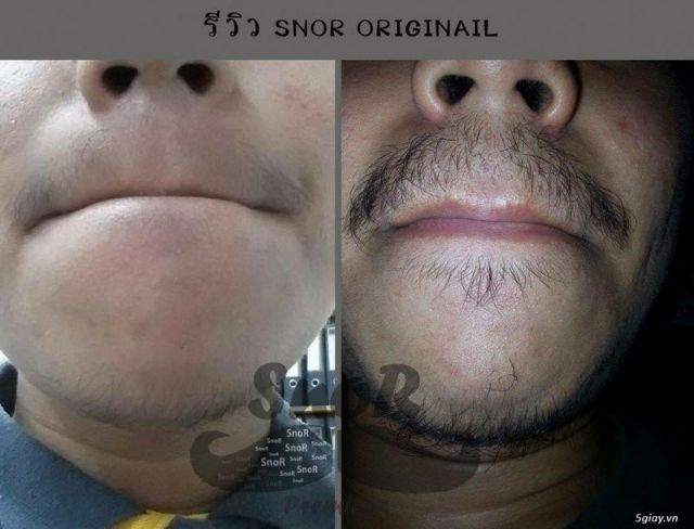 Mọc Tóc Râu Lông Mày Mi SNOR Chính Hãng