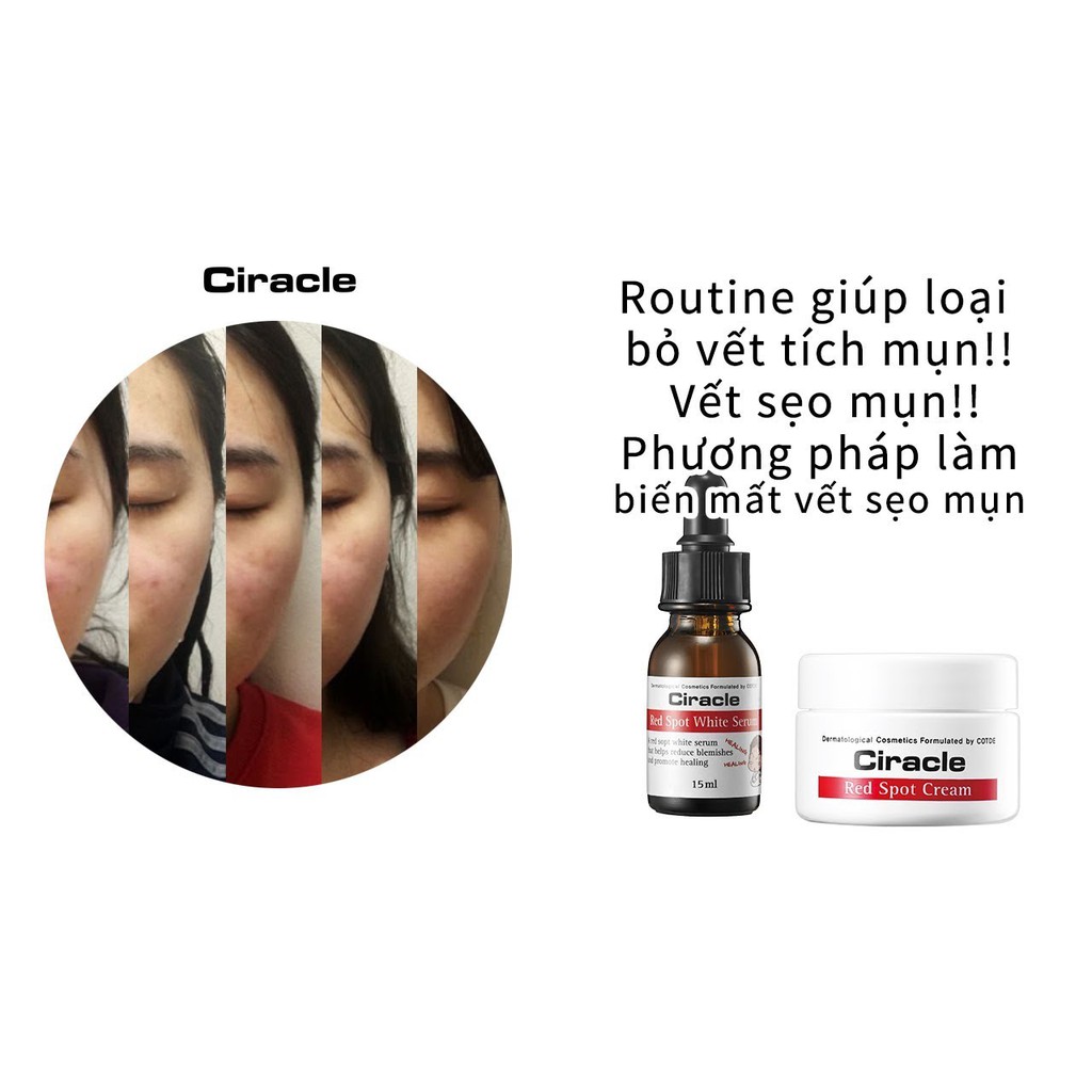 Tinh chất dưỡng sáng da, chống nhăn hiệu quả Ciracle Hydre B5 Source Wrinkle 30ml