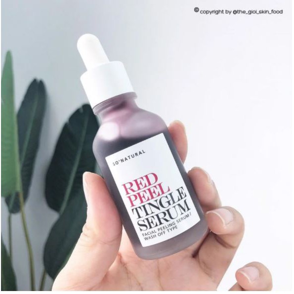 Tinh Chất Tẩy Da Chết Hóa Học So' Natural Red Peel Tingle Serum 35ml | BigBuy360 - bigbuy360.vn