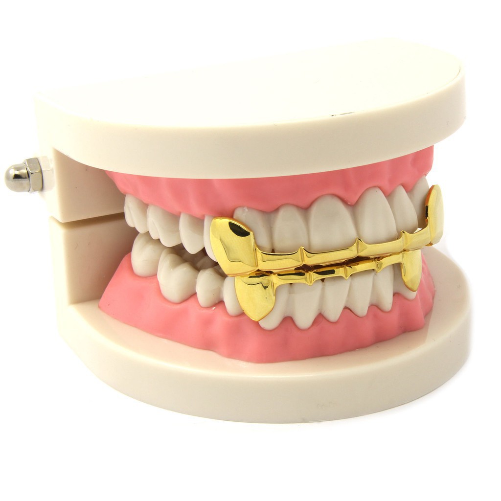 Bộ phụ kiện bọc răng mạ vàng 14K tùy chỉnh vừa vặn với răng phong cách Hiphop độc đáo cho hàm trên & dưới