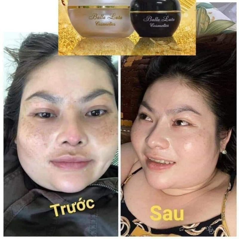 Cao Nám Balla Luta Lớn 30gr Chính Hãng