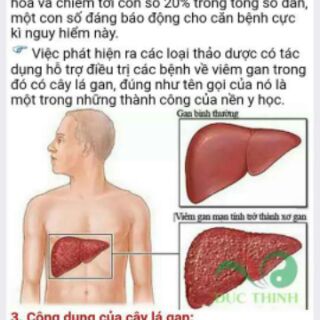 [FREESHIP 99K TOÀN QUỐC] Cây lá gan