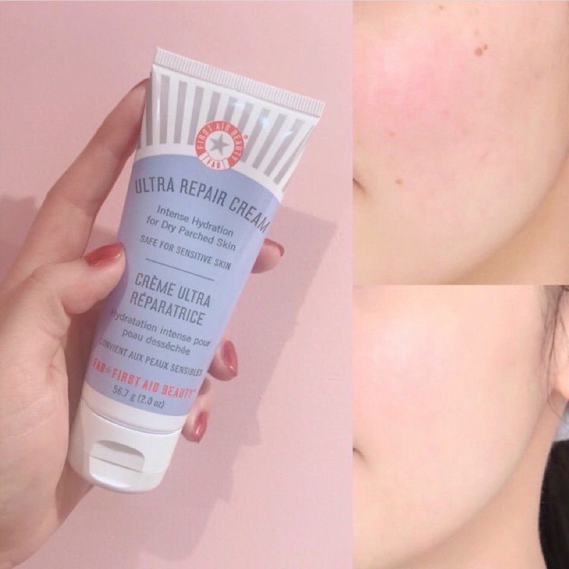 KEM DƯỠNG ẨM PHỤC HỒI DA ĐÌNH ĐÁM FIRST AID BEAUTY ULTRA REPAIR CREAM