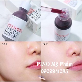 Thay da sinh học RED PEEL 35ml (Chai mới)