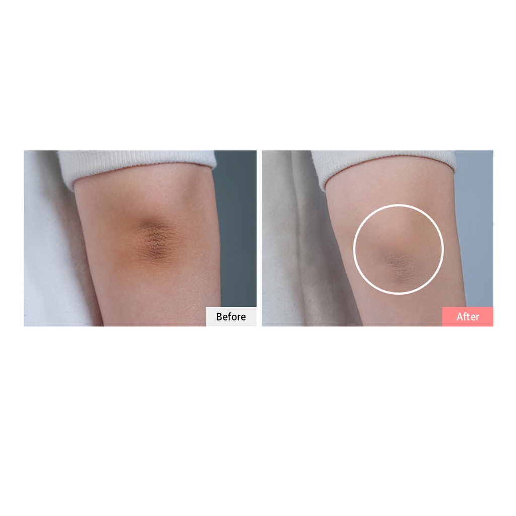 Bộ Kem Làm Trắng Da Cosnori 50ml