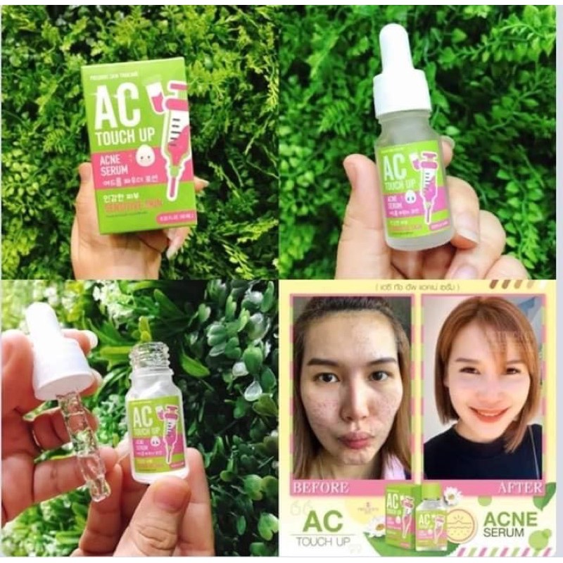 SERUM GIẢM MỤN AC