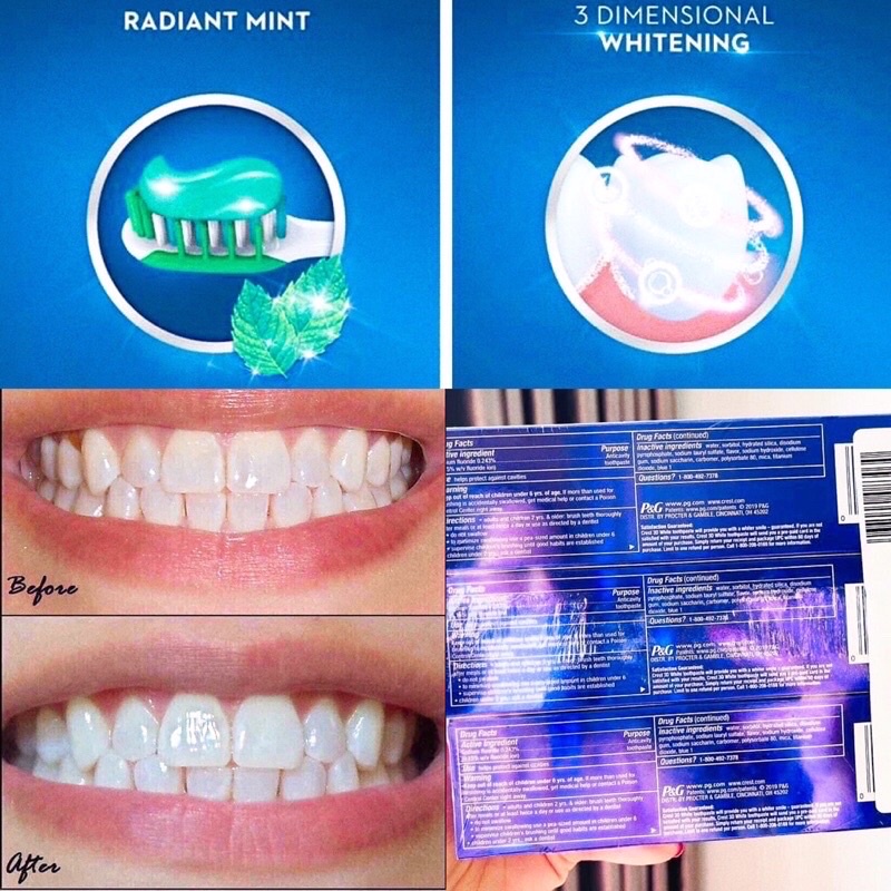 Kem đánh răng Crest 3D White Radiant Mint Mỹ cực trắng răng