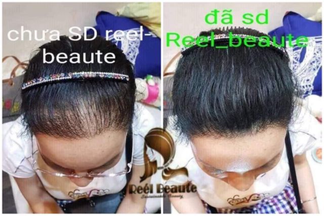 (GIÁ SỐC ) TÚI LỌC GỘI ĐẦU REEL BEAUTE  TRỊ RỤNG TÓC (CẦN THƠ 17)