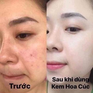 Kem Hoa Cúc PauJenPai (Kem ban đêm)