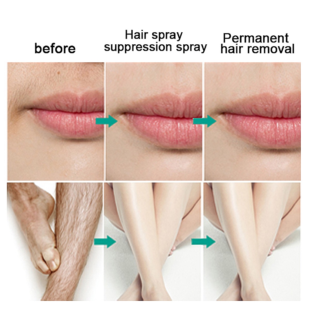 Tinh Chất Xịt Tẩy Lông Agdoad 20ML Không Gây Đau Đớn Dành Cho Vùng Da Chân / Vùng Kín / Vùng Da Dưới Cánh Tay / Chân