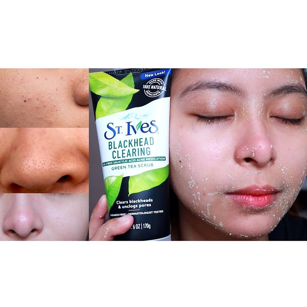 [USA] Sữa rửa mặt St.Ives Blackhead Clearing 170g Green tea &amp; Bamboo Scrub Trà xanh sạch mụn đầu đen - Mỹ