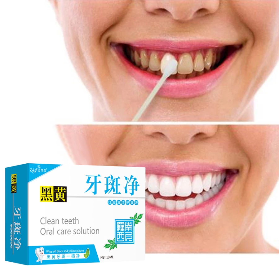 Tinh Chất Làm Trắng Răng Loại Bỏ Vết Ố Trên Răng Tiện Dụng