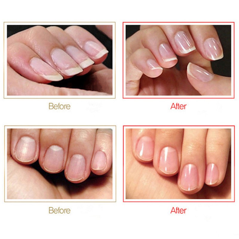 Cây Dũa Móng Tay Chuyên Dụng Làm Nail, dũa Móng Tay Bằng Kính Nano Chuyên Nghiệp Mài Đánh Bóng Trong Suốt Có Hộp