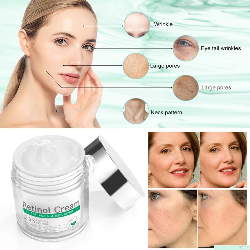 Kem dưỡng ẩm Retinol chống lão hóa làm trắng da mặt 50ml