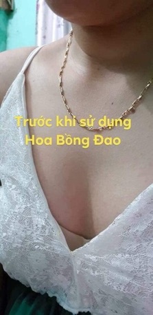 Hoa bông đào( nở ngực)