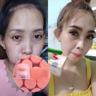 Bộ combo serum+kem collagen plus vit E