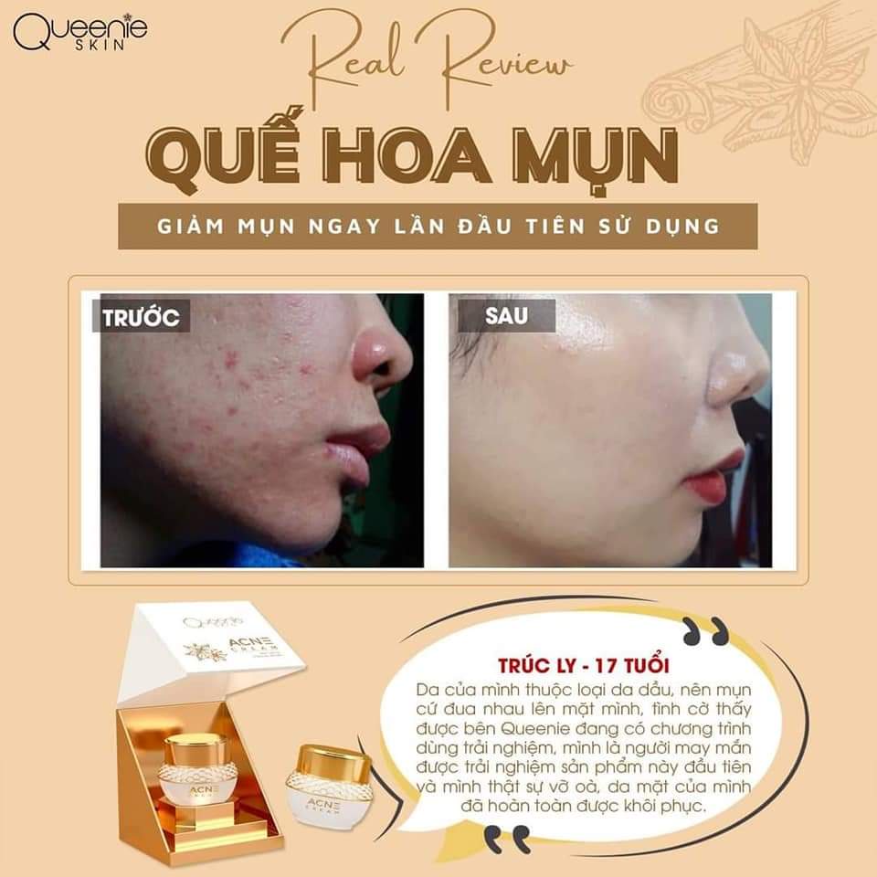 QUẾ HOA MỤN _ Kem chấm mụn đầu đen, mụn ẩn, giảm thâm mụn, dưỡng trắng đều màu da, se khít lỗ chân lông Queenie skin | BigBuy360 - bigbuy360.vn