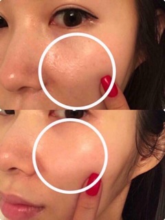 RED PEEL THAY DA SINH HỌC 20ML